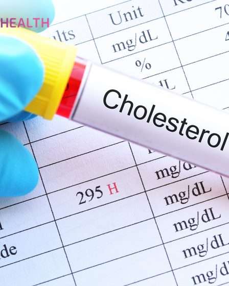 Bahaya Kolesterol Tinggi dan Cara Mencegahnya